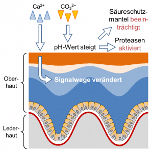 Wasserhärte beeinflusst Neurodermitis