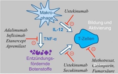 schuppenflechte psoriasis behandlung 