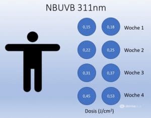 Sonnenallergie polymorphe Lichtdermatose Hardening UVB Kurzzeitdesensibilisierung