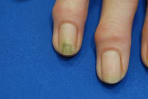 gruene naegel nägel nagelpflege
