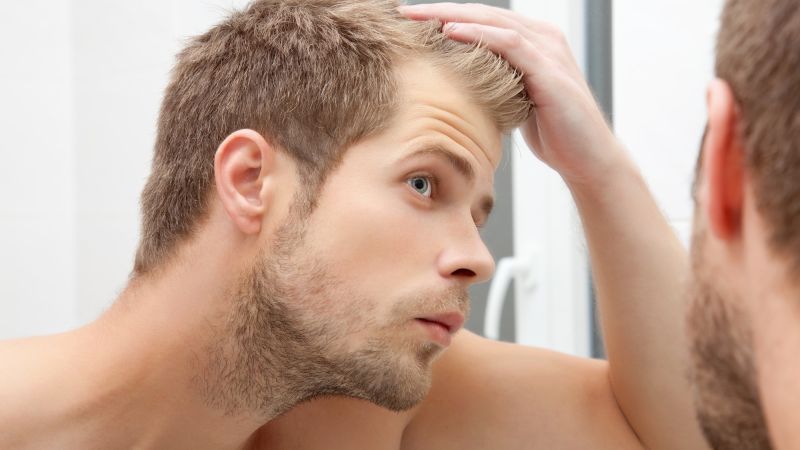 Tacrolimus – keine Therapiealternative bei kreisrundem Haarausfall